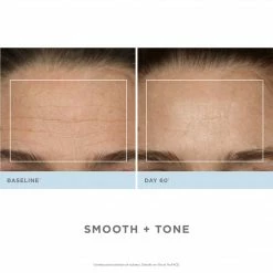 NuFACE Trinity Pro Facial Toning Kit