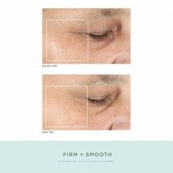 NuFACE Trinity Effective Lip & Eye Attachment