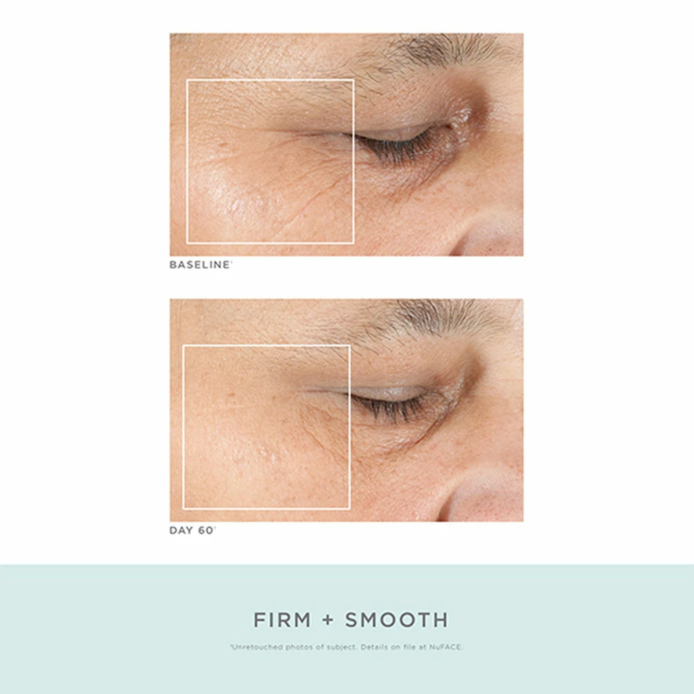 NuFACE Trinity Pro Facial Toning Kit + ELE 8 NuFACE Trinity Pro Facial Toning Kit + ELE