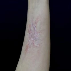 Out Of Kit Healed Burn Scar 3 Special FX