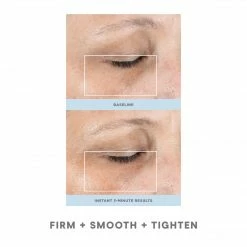 NuFACE FIX 9 NuFACE FIX