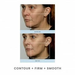 NuFACE Trinity Pro Facial Toning Kit + Wrinkle Reducer